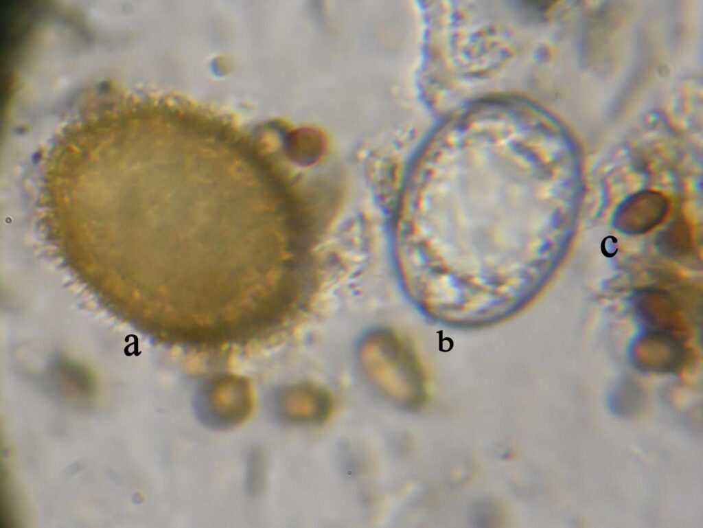 Σπόρια από, a. Tuber rufum,  b. Barssia hellenica, c. Melanogaster sp.