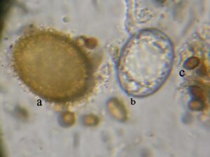 Σπόρια από, a. Tuber rufum, b. Barssia hellenica, c. Melanogaster sp.
